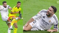 Real Madrid xác nhận điều tồi tệ với Dani Carvajal 